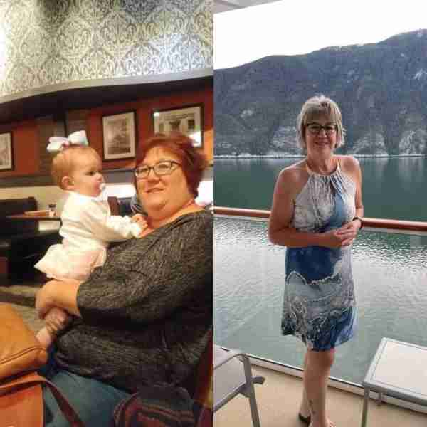 Today is my 1 year anniversary of my weight loss journey 🤩 Dont wait, I did it at age 54. I wish I'...