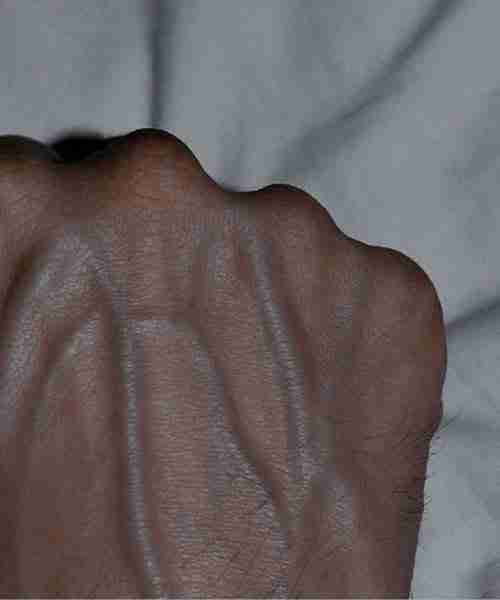 If your veins are visible in your hand, it is a signal of ca… See more