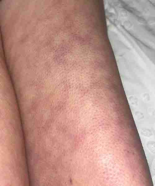 These are the consequences of sleeping with the... See more 😯